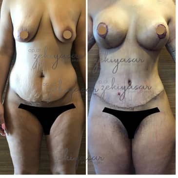 Slider image (10) Dr. Zeki Yasar Clinic